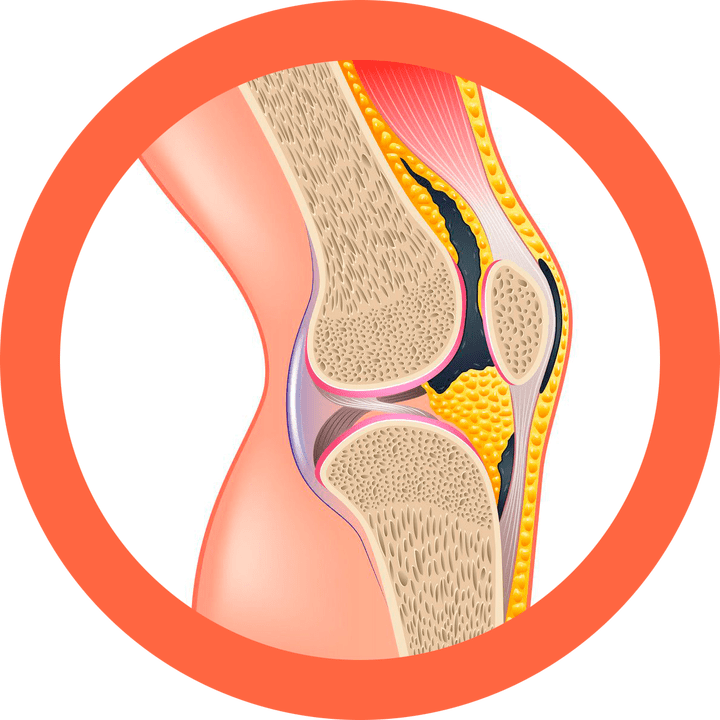 Hondroten – atkuria sąnarius ir raumenis