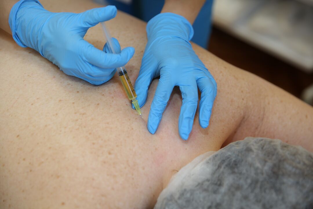 chondroprotektorių injekcijos nugarai