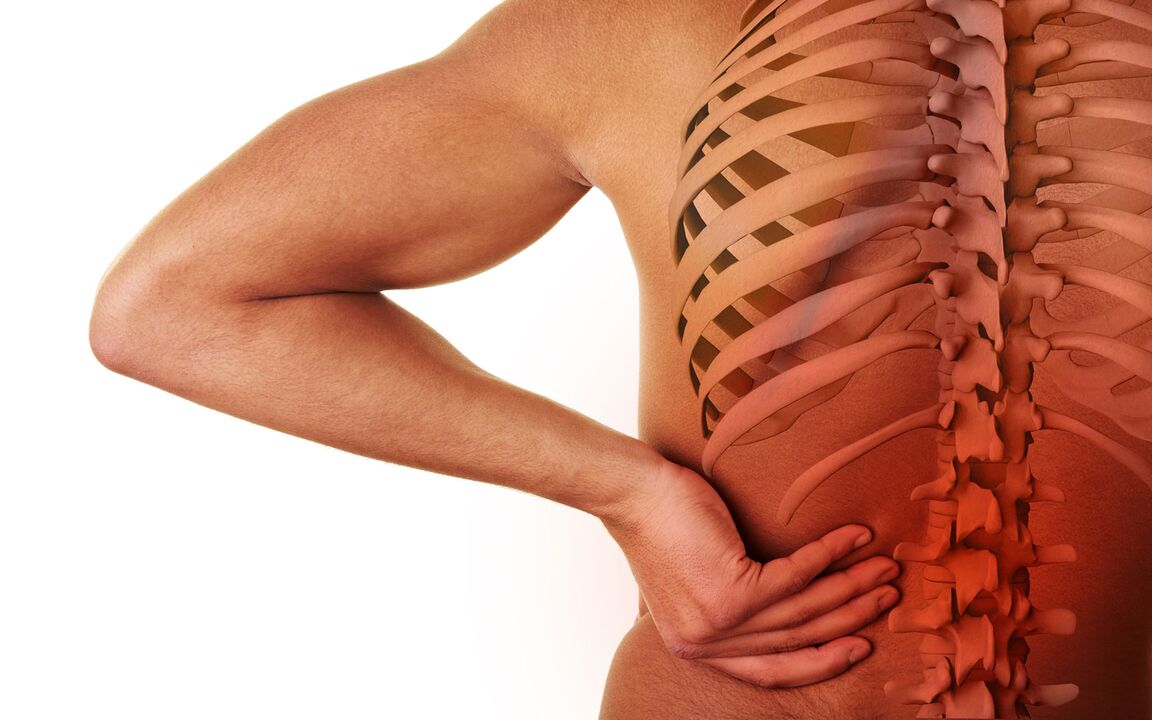 juosmens osteochondrozės simptomai